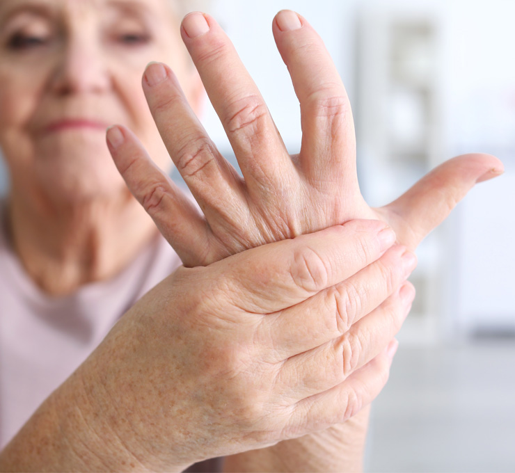 Learn More About Arthritis in the Wrist and Thumb