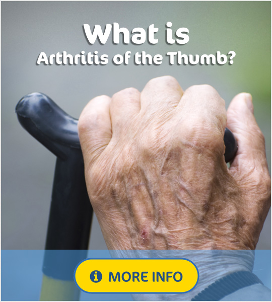 What is arthritis of the Thumb