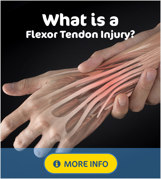 What is a flexor tendon injury