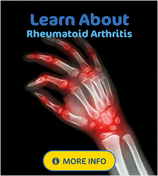 What is rheumatoid arthritis of the wrist