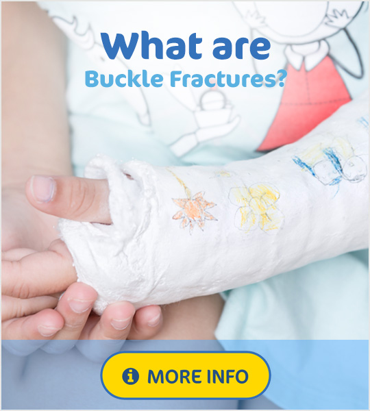 What are Buckle Fractures?