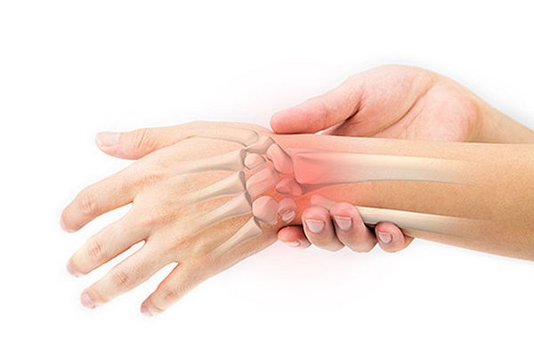 Wrist pain caused by sprained wrist inflammation