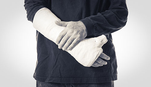 A cast is often required for the treatment of skier's thumb