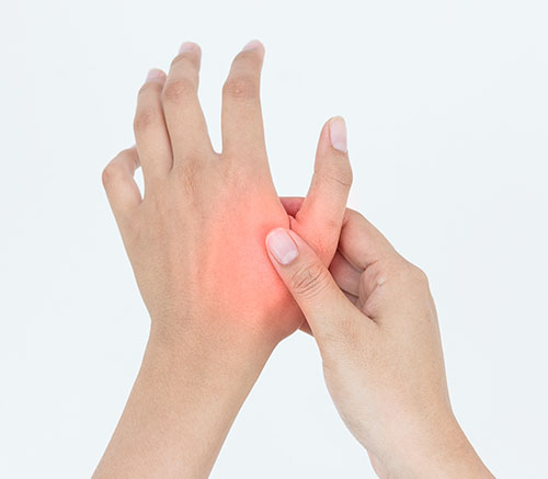 Basal Joint Arthritis