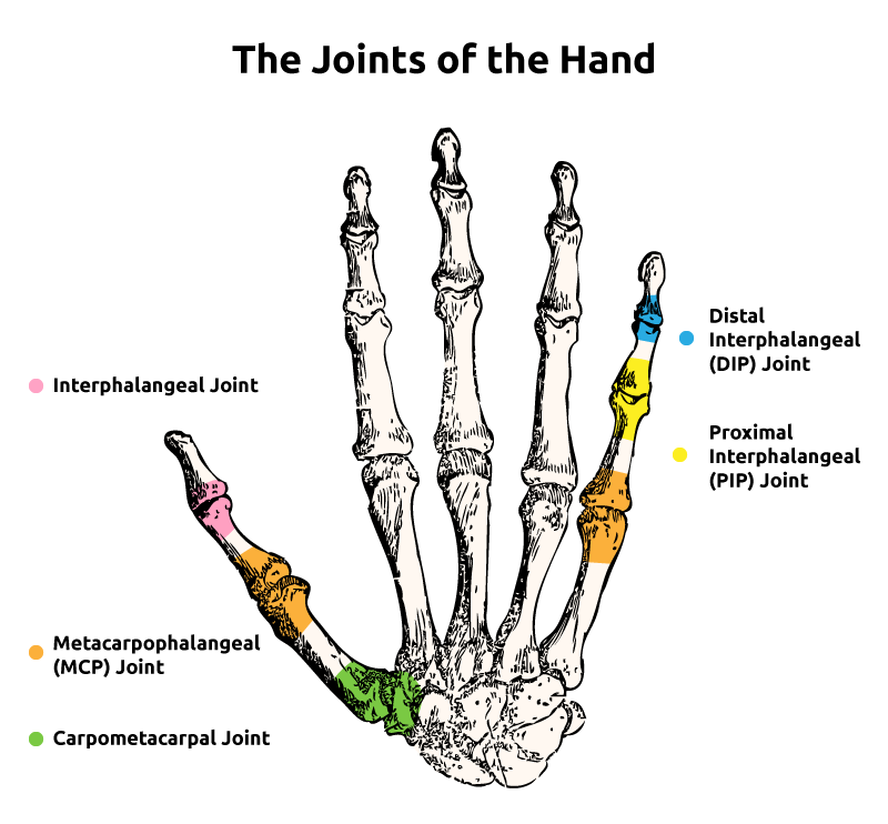What Is MCP Joint Arthritis? - WristSupports.co.uk