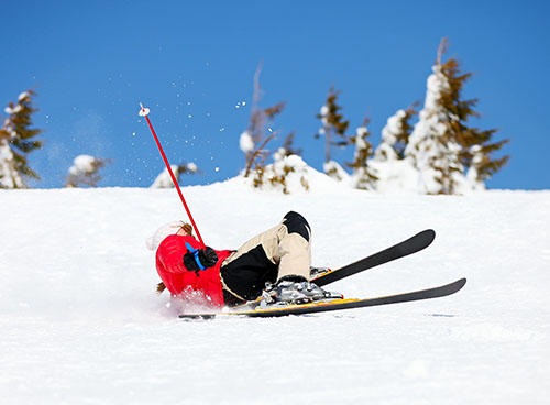 Falling on an outstretched hand while gripping a ski pole is a common cause of skier's thumb