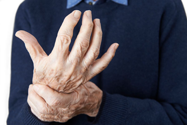 What is Arthritis?