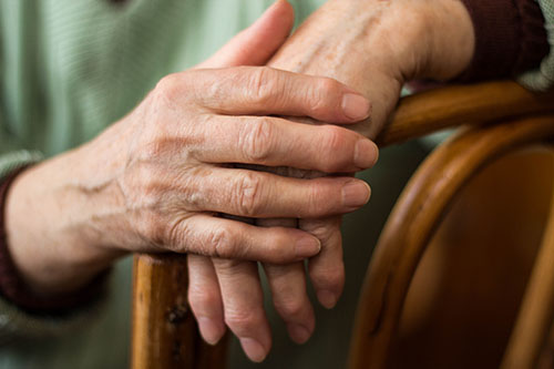 Arthritis is a common condition that wears down the cartilage in the joints, causing pain and swelling