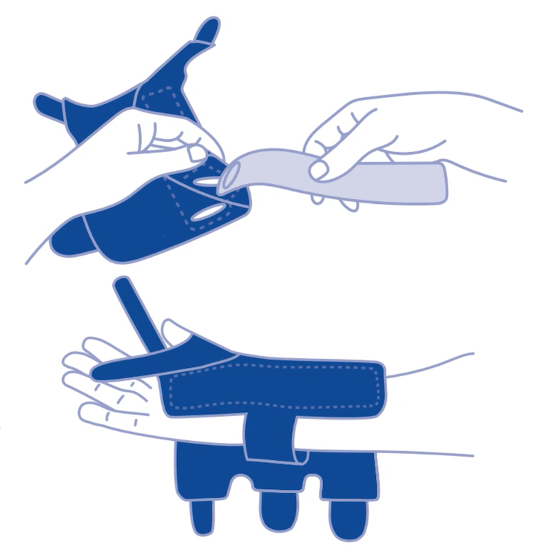 Application instructions for the Actimove Gauntlet Wrist Stabiliser Application instructions for the Actimove Gauntlet Wrist Stabiliser