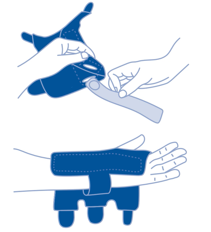 Application instructions for the Actimove Manus Wrist Stabiliser Application instructions for the Actimove Manus Wrist Stabiliser