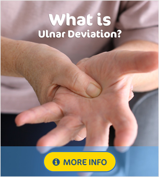 Best supports for ulnar deviation